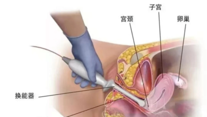 澳门赤兔版2025资料,男子酒后死亡同饮者没劝酒被判无责,经典解释落实_尊享版V8.24